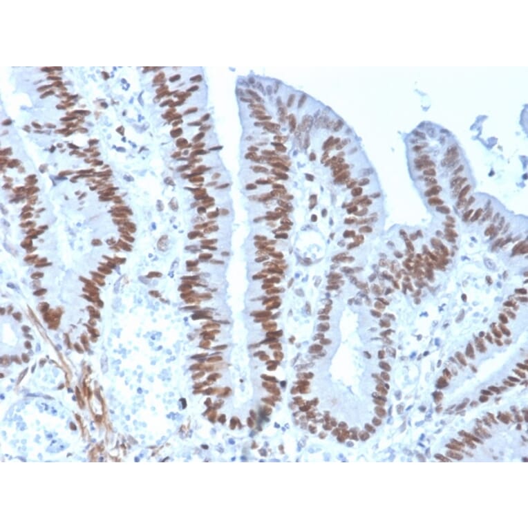 Immunohistochemistry - Anti-MSH6 Antibody [rMSH6/4743] (A248780) - Antibodies.com