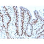 Immunohistochemistry - Anti-MSH6 Antibody [rMSH6/4743] (A248780) - Antibodies.com