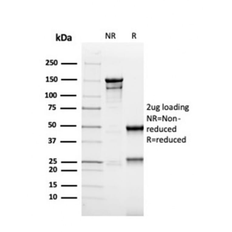 SDS-PAGE - Anti-MSH6 Antibody [rMSH6/4743] (A248781) - Antibodies.com