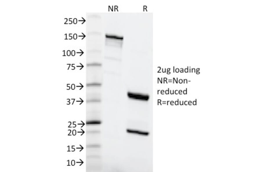 SDS-PAGE - Anti-MSH6 Antibody [MSH6/2111] (A248782) - Antibodies.com