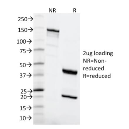 SDS-PAGE - Anti-MSH6 Antibody [MSH6/2111] (A248782) - Antibodies.com