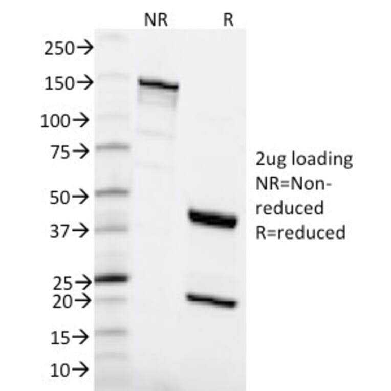 SDS-PAGE - Anti-MSH6 Antibody [MSH6/2111] (A248782) - Antibodies.com