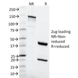 SDS-PAGE - Anti-MSH6 Antibody [MSH6/2111] (A248782) - Antibodies.com