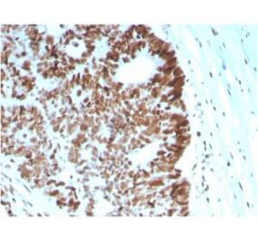 Immunohistochemistry - Anti-MSH6 Antibody [MSH6/2927] (A248783) - Antibodies.com