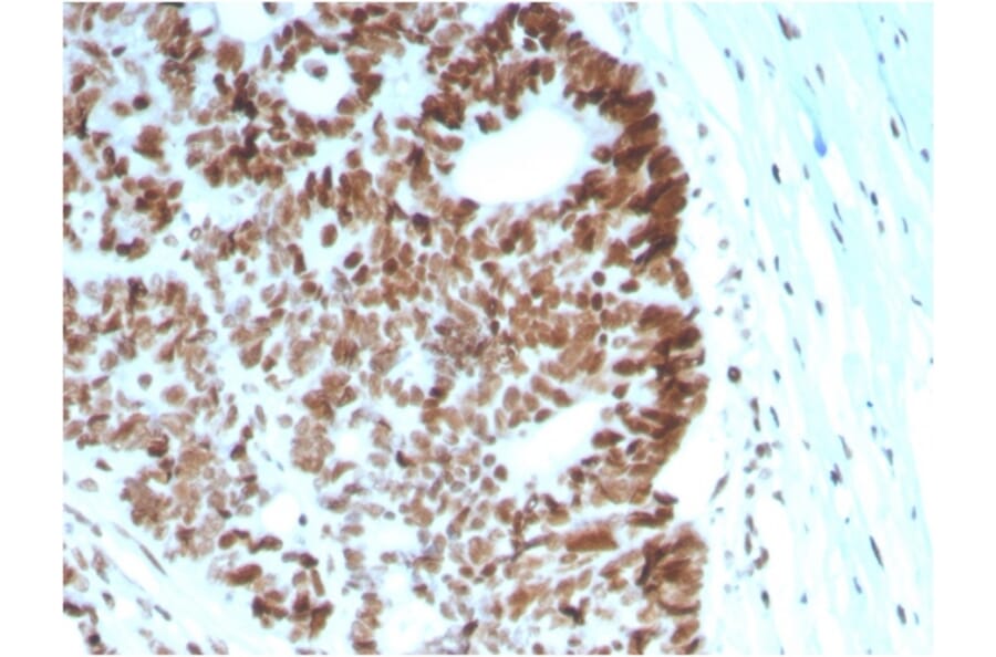 Immunohistochemistry - Anti-MSH6 Antibody [MSH6/2927] (A248783) - Antibodies.com