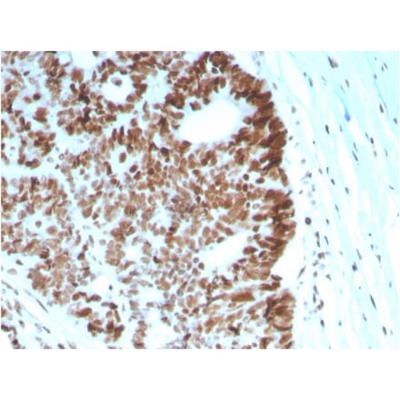 Immunohistochemistry - Anti-MSH6 Antibody [MSH6/2927] (A248783) - Antibodies.com
