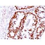 Immunohistochemistry - Anti-MSH6 Antibody [MSH6/3085] (A248784) - Antibodies.com