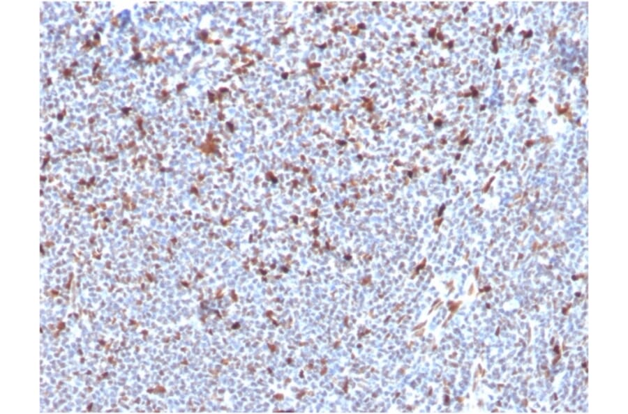 Immunohistochemistry - Anti-MSH6 Antibody [MSH6/3085] (A248784) - Antibodies.com