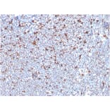 Immunohistochemistry - Anti-MSH6 Antibody [MSH6/3085] (A248784) - Antibodies.com