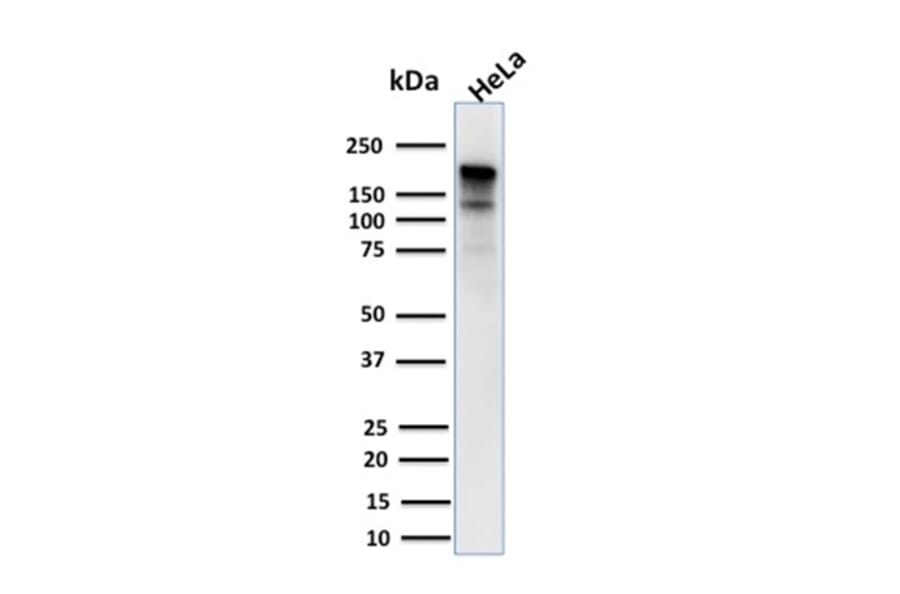 Western Blot - Anti-MSH6 Antibody [MSH6/3085] (A248784) - Antibodies.com