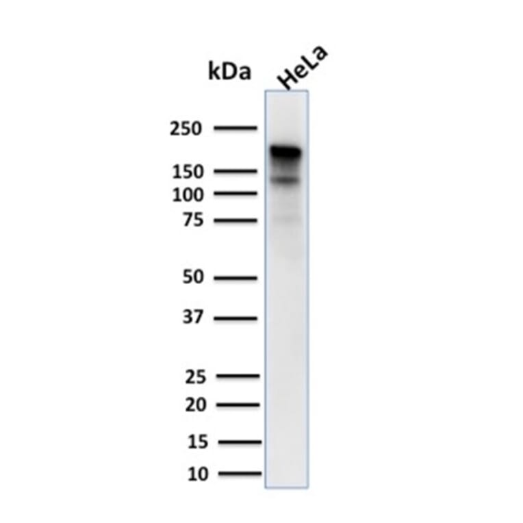 Western Blot - Anti-MSH6 Antibody [MSH6/3085] (A248784) - Antibodies.com