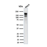 Western Blot - Anti-MSH6 Antibody [MSH6/3085] (A248784) - Antibodies.com