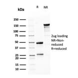 SDS-PAGE - Anti-MSH6 Antibody [MSH6/3085] (A248784) - Antibodies.com