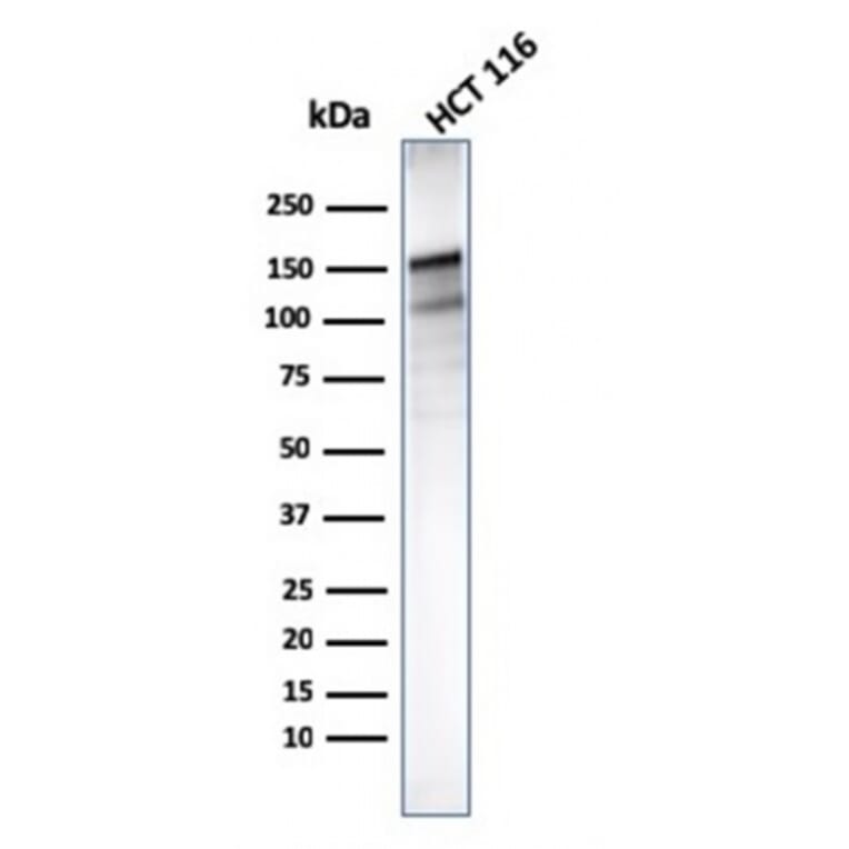 Western Blot - Anti-MSH6 Antibody [MSH6/3085] (A248784) - Antibodies.com