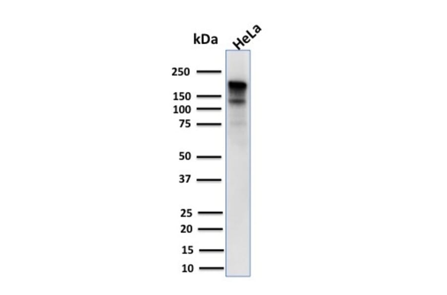 Western Blot - Anti-MSH6 Antibody [MSH6/3085] (A248784) - Antibodies.com