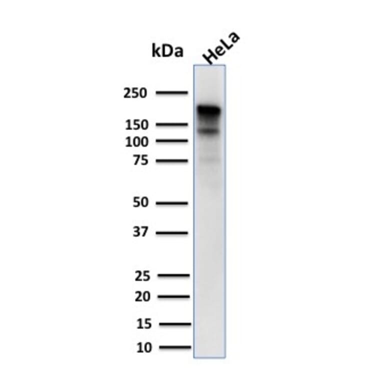 Western Blot - Anti-MSH6 Antibody [MSH6/3085] (A248784) - Antibodies.com