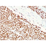 Immunohistochemistry - Anti-MSH6 Antibody [MSH6/3086] (A248785) - Antibodies.com