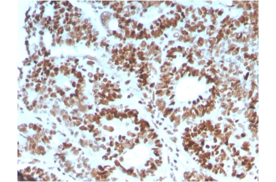 Immunohistochemistry - Anti-MSH6 Antibody [MSH6/3086] (A248785) - Antibodies.com