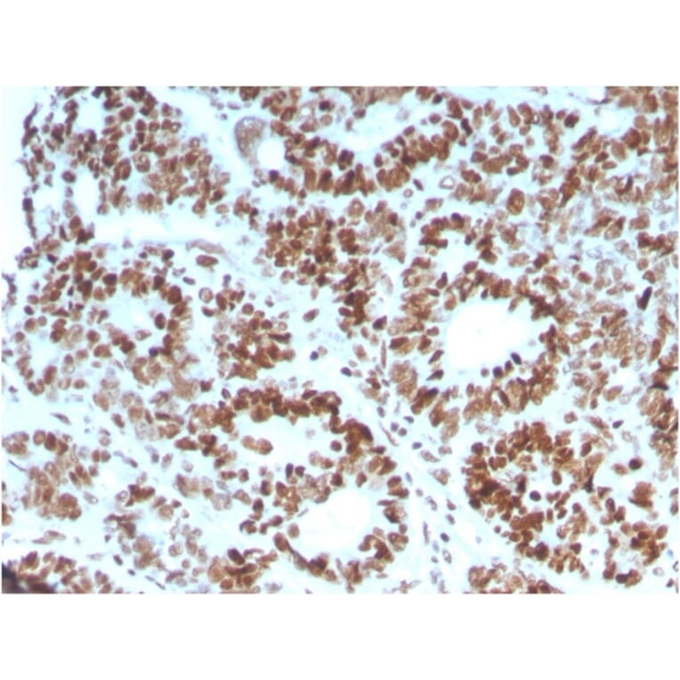 Immunohistochemistry - Anti-MSH6 Antibody [MSH6/3086] (A248785) - Antibodies.com