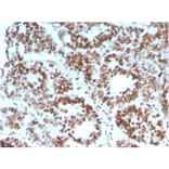 Immunohistochemistry - Anti-MSH6 Antibody [MSH6/3086] (A248785) - Antibodies.com