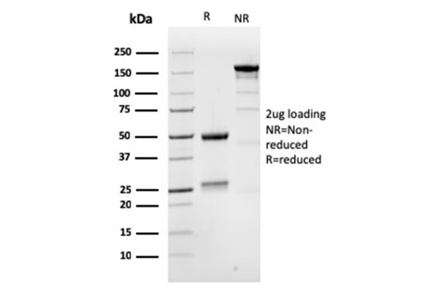 SDS-PAGE - Anti-MSH6 Antibody [MSH6/3086] (A248785) - Antibodies.com