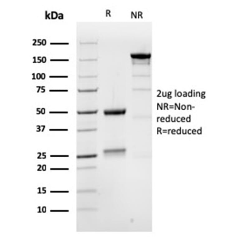 SDS-PAGE - Anti-MSH6 Antibody [MSH6/3086] (A248785) - Antibodies.com