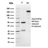 SDS-PAGE - Anti-MSH6 Antibody [MSH6/3086] (A248785) - Antibodies.com