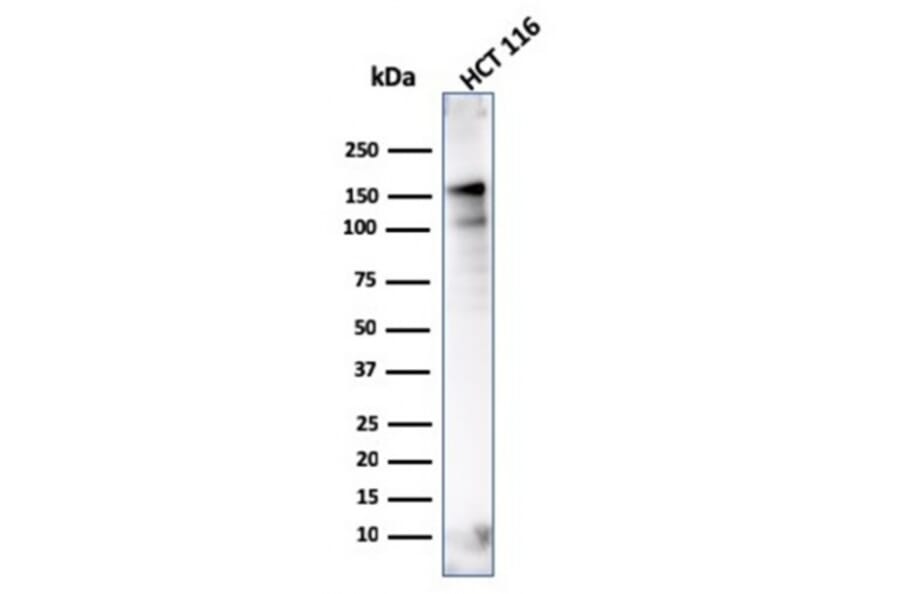 Western Blot - Anti-MSH6 Antibody [MSH6/3086] (A248785) - Antibodies.com
