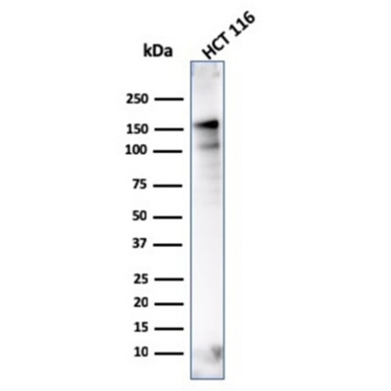 Western Blot - Anti-MSH6 Antibody [MSH6/3086] (A248785) - Antibodies.com