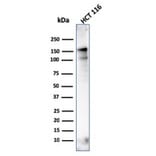 Western Blot - Anti-MSH6 Antibody [MSH6/3086] (A248785) - Antibodies.com