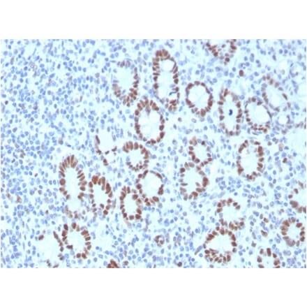 Immunohistochemistry - Anti-MSH6 Antibody [MSH6/3089] (A248786) - Antibodies.com