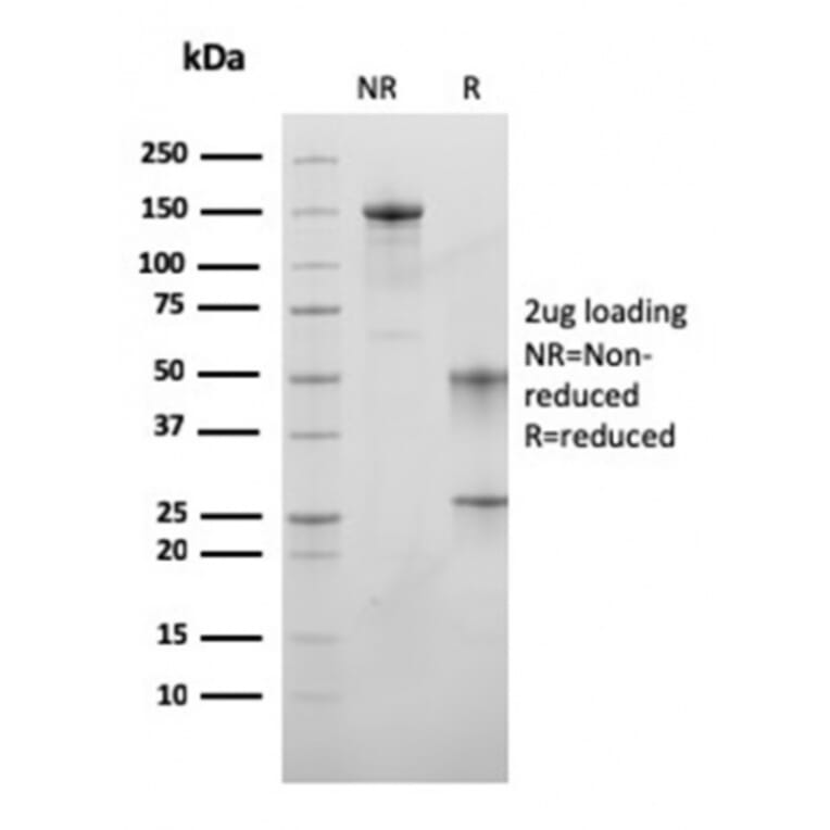 SDS-PAGE - Anti-MSH6 Antibody [MSH6/3089] (A248786) - Antibodies.com