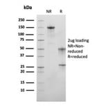 SDS-PAGE - Anti-MSH6 Antibody [MSH6/3089] (A248786) - Antibodies.com