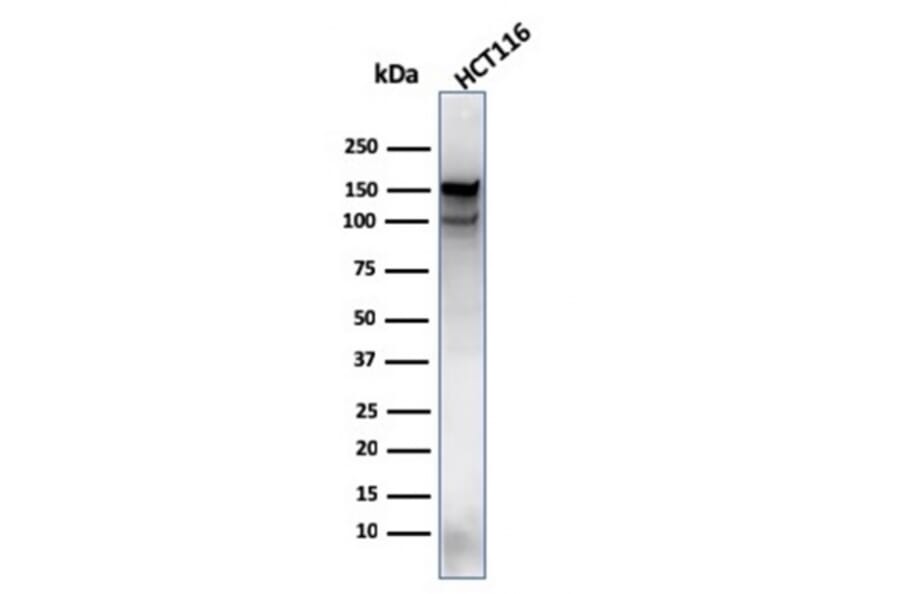 Western Blot - Anti-MSH6 Antibody [MSH6/3089] (A248786) - Antibodies.com