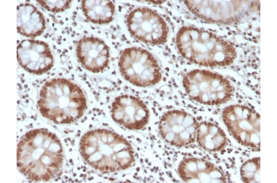 Immunohistochemistry - Anti-MSH6 Antibody [MSH6/4592R] (A248786) - Antibodies.com
