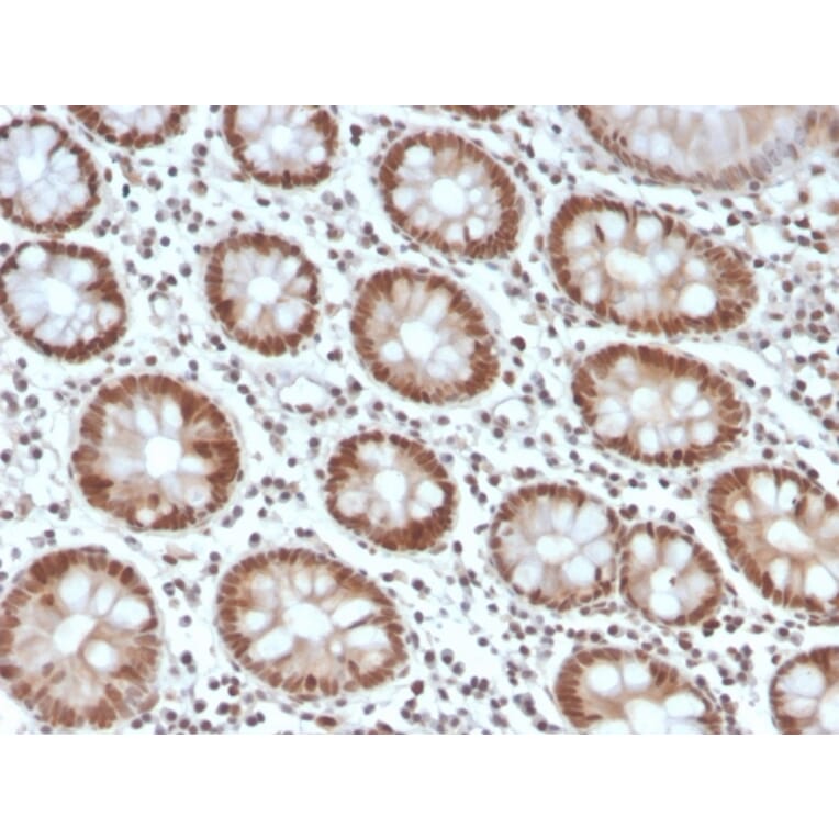 Immunohistochemistry - Anti-MSH6 Antibody [MSH6/4592R] (A248786) - Antibodies.com