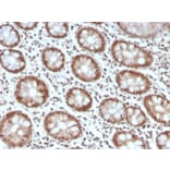 Immunohistochemistry - Anti-MSH6 Antibody [MSH6/4592R] (A248786) - Antibodies.com