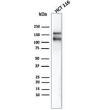 Western Blot - Anti-MSH6 Antibody [MSH6/4592R] (A248787) - Antibodies.com