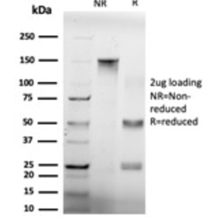 SDS-PAGE - Anti-GTF2H2 Antibody [PCRP-GTF2H2-1B9] (A248788) - Antibodies.com