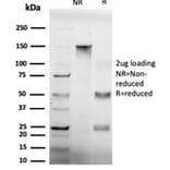 SDS-PAGE - Anti-GTF2H2 Antibody [PCRP-GTF2H2-1B9] (A248788) - Antibodies.com