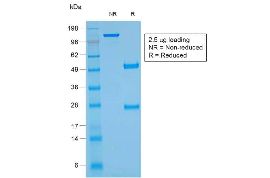 SDS-PAGE - Anti-Glycophorin A Antibody [rGYPA/280] (A248792) - Antibodies.com