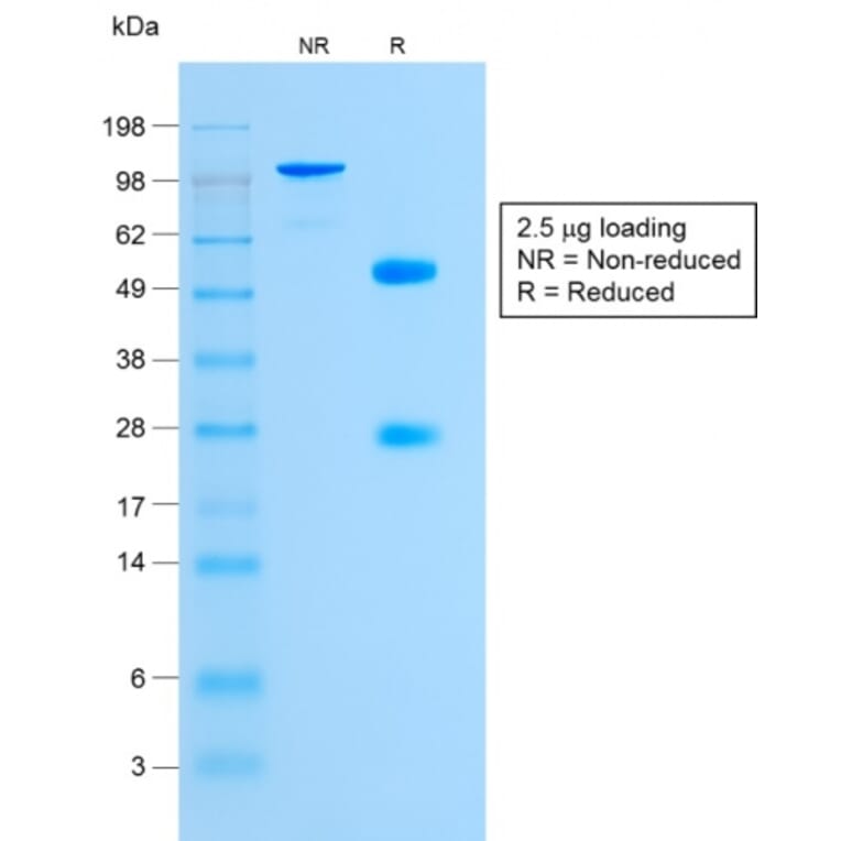 SDS-PAGE - Anti-Glycophorin A Antibody [GYPA/1725R] (A248793) - Antibodies.com
