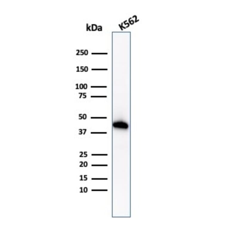 Western Blot - Anti-Glycophorin A Antibody [GYPA/1725R] (A248793) - Antibodies.com