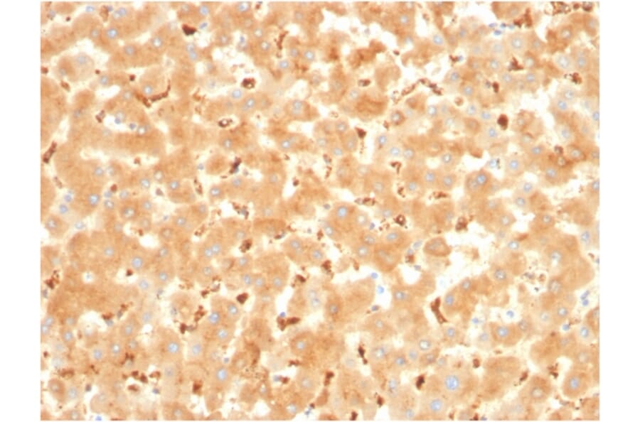 Immunohistochemistry - Anti-alpha 2 Macroglobulin Antibody [A2M/3621] (A248796) - Antibodies.com