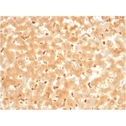Immunohistochemistry - Anti-alpha 2 Macroglobulin Antibody [A2M/3621] (A248796) - Antibodies.com