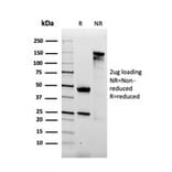 SDS-PAGE - Anti-alpha 2 Macroglobulin Antibody [A2M/3621] (A248796) - Antibodies.com