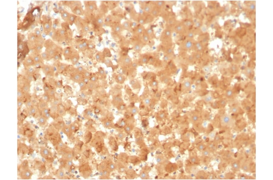 Immunohistochemistry - Anti-alpha 2 Macroglobulin Antibody [A2M/3623] (A248797) - Antibodies.com