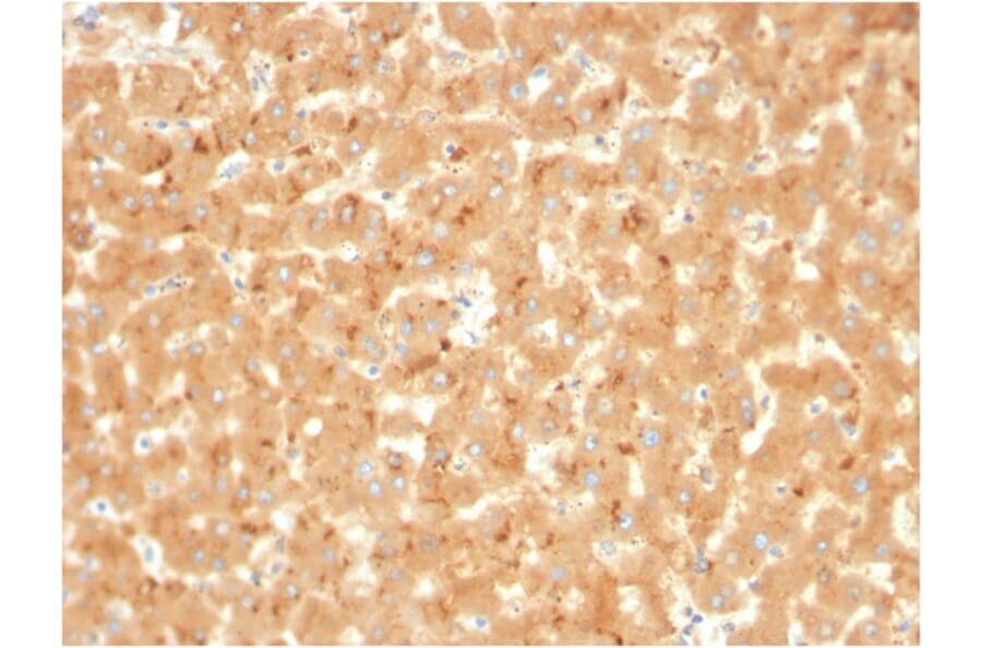 Immunohistochemistry - Anti-alpha 2 Macroglobulin Antibody [A2M/3623] (A248797) - Antibodies.com
