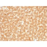 Immunohistochemistry - Anti-alpha 2 Macroglobulin Antibody [A2M/3623] (A248797) - Antibodies.com