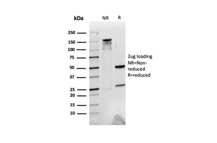 SDS-PAGE - Anti-alpha 2 Macroglobulin Antibody [A2M/3623] (A248797) - Antibodies.com